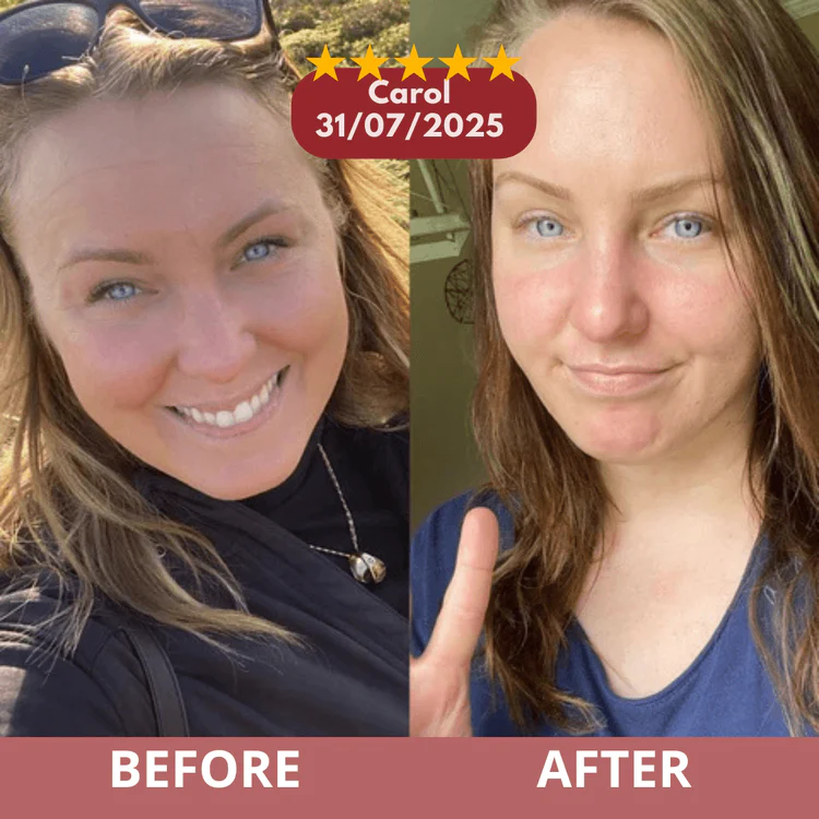 After - Carol M.