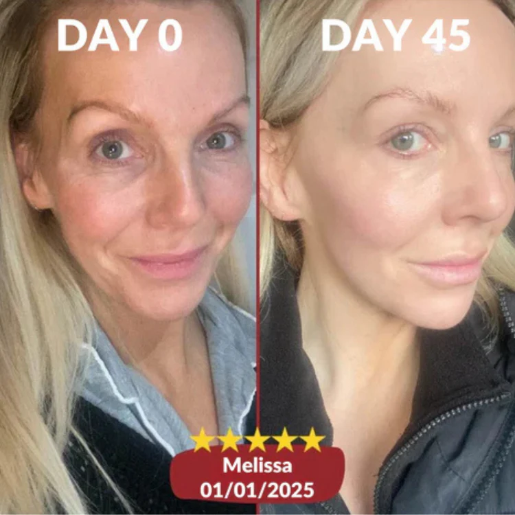 After - Melissa T.