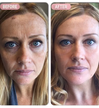 After - Amanda P.