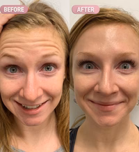 After - Laura D.